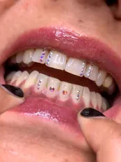 Perlas Gems